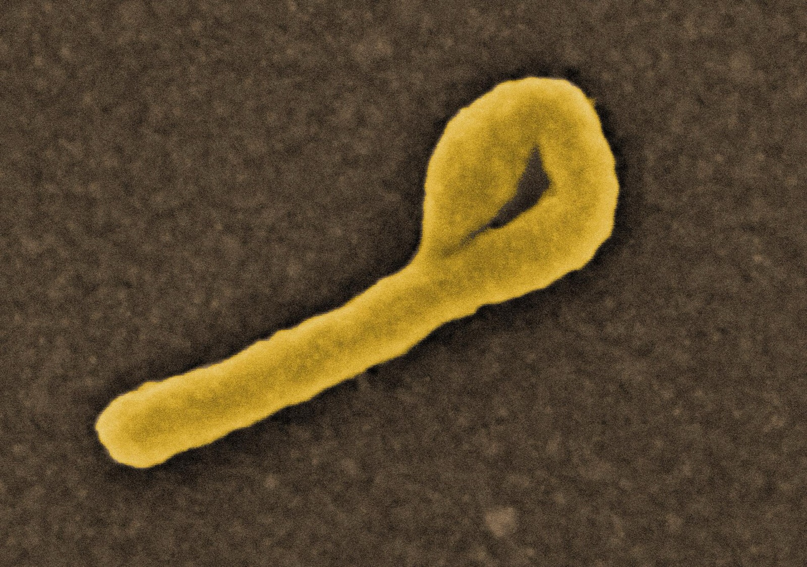 An Ebola virus particle under an electron microscope. Image: NIAID / Wikimedia Commons (CC BY 2.0)