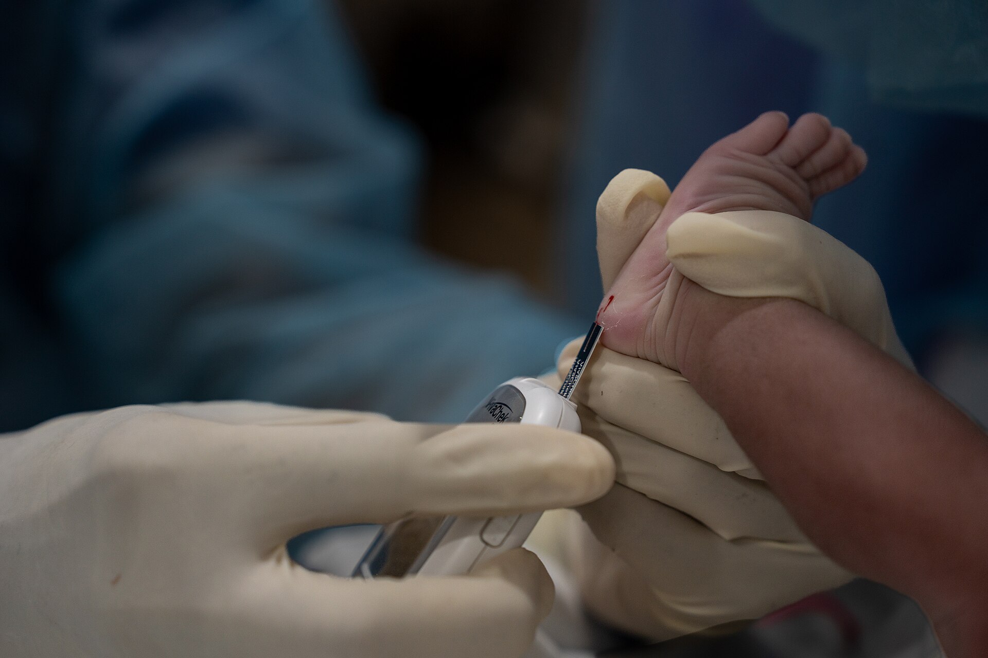 A newborn is checked in a maternity ward in Ghana in 2025.